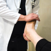 foot Car Accident Injury Treatment | Chiropractor Babylon | Dr. Donald Chiappetta